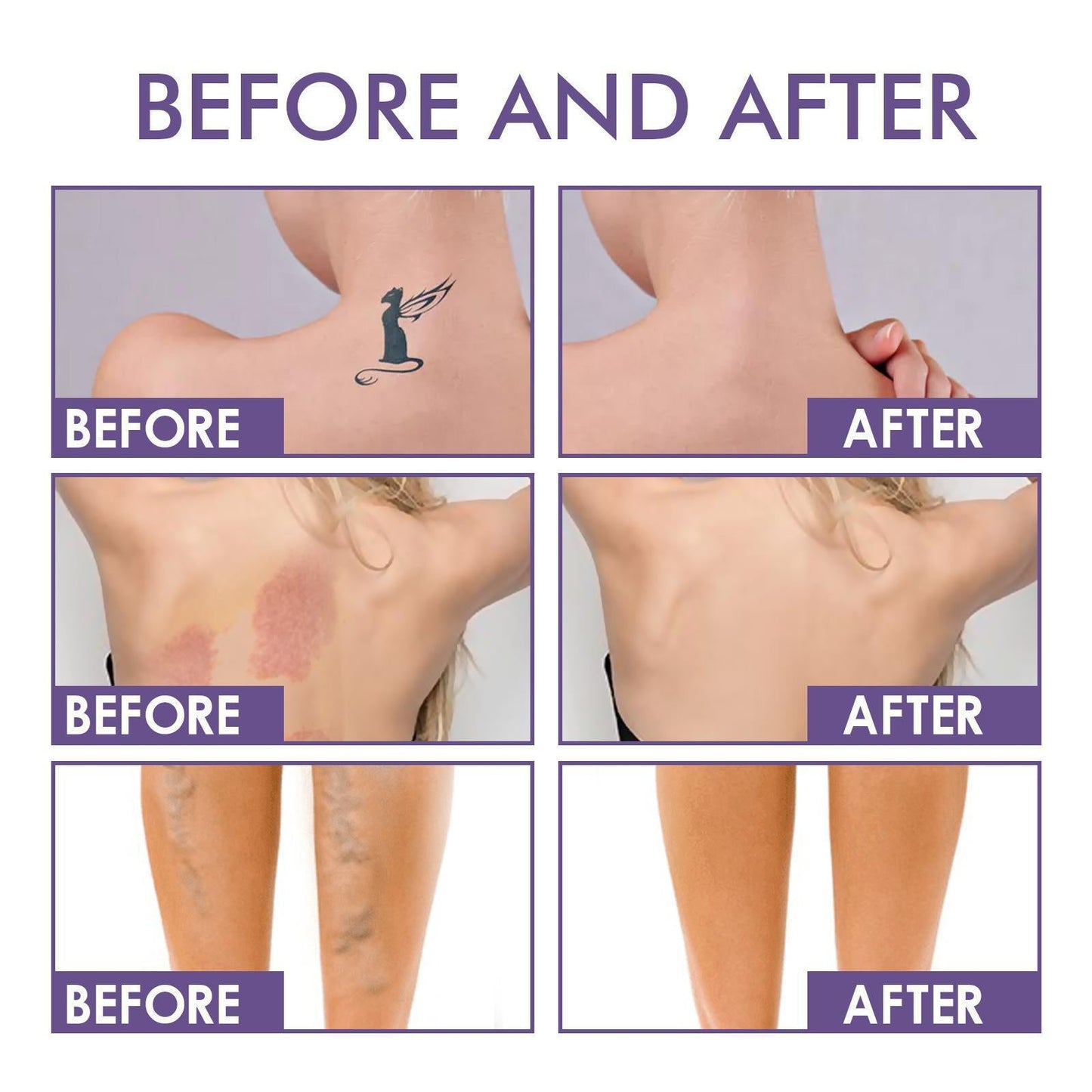 💜Ostatni dzień – kup 1, a 1 dostaniesz gratis!💜✨Body Perfector – wodoodporny, lekki i nieskazitelny makijaż ciała