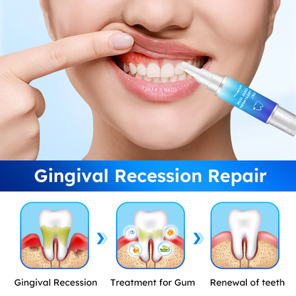 Żel do dziąseł Fivfivgo™ do stosowania w jamie ustnej
