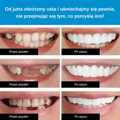 Protezy SorriBem Perfect Smile