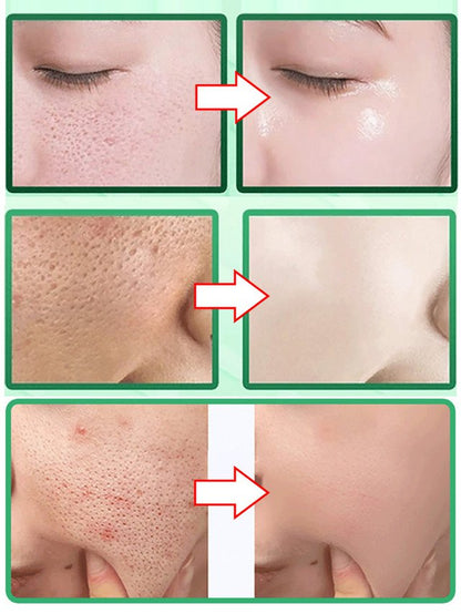 Maska bąbelkowa trawy śnieżnej