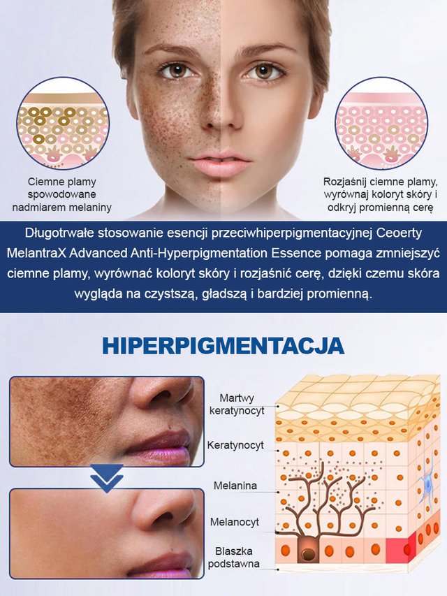 Różne plamy znikają Spray wybielający do usuwania plam