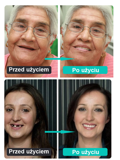 【Klasa medyczna】Zestaw protez opatentowany w USA