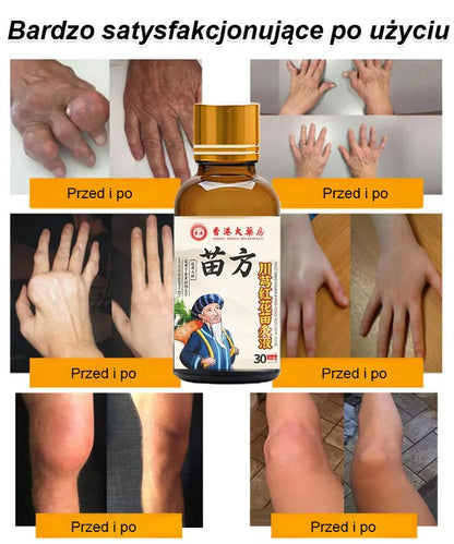 Płyn do akupunktury z korzenia chuanxiong i kwiatu czerwonego krokosza