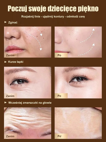 [Usuwanie zmarszczek] Dr. Yunmei Bozen serum przeciwzmarszczkowe