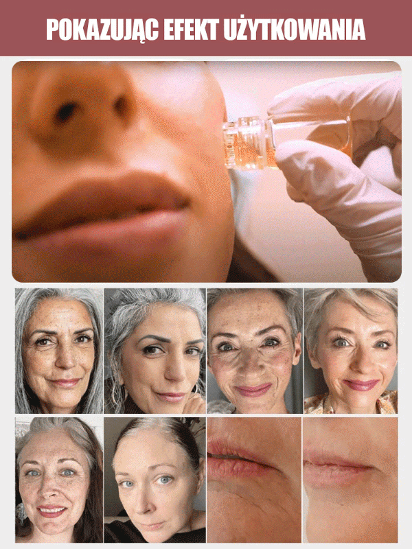 Mikroigłowe serum przeciwzmarszczkowe