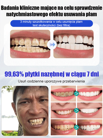Hydroksyapatyt Whitening Pasta do zębów