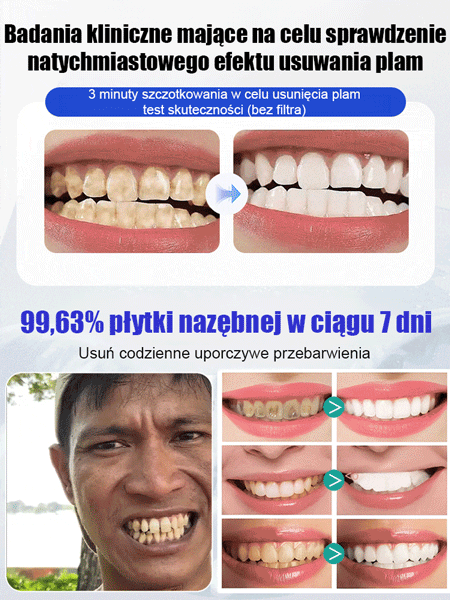 Hydroksyapatyt Whitening Pasta do zębów