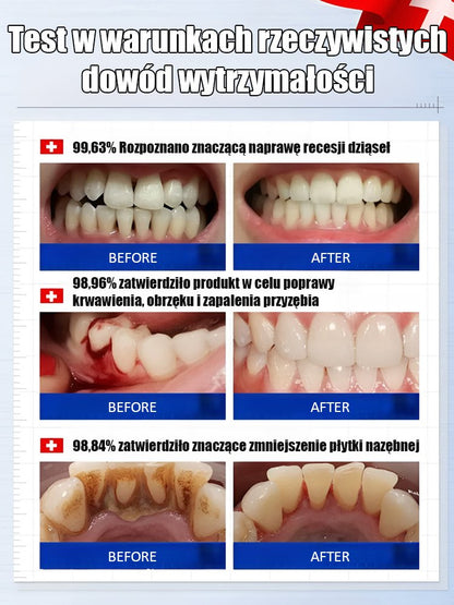 Hydroksyapatyt Whitening Pasta do zębów