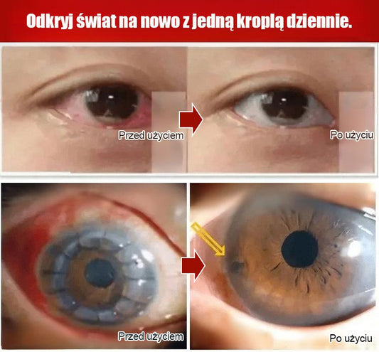 LANISKA krople do oczu z miodem do pielęgnacji oczu