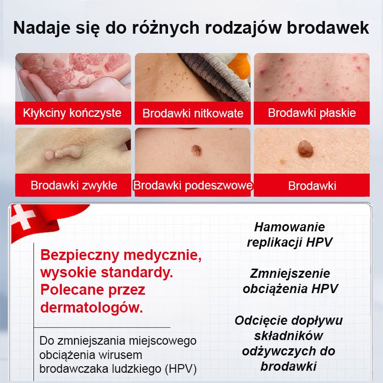 【Jednosekundowy usuwacz brodawek】Krem do usuwania brodawek