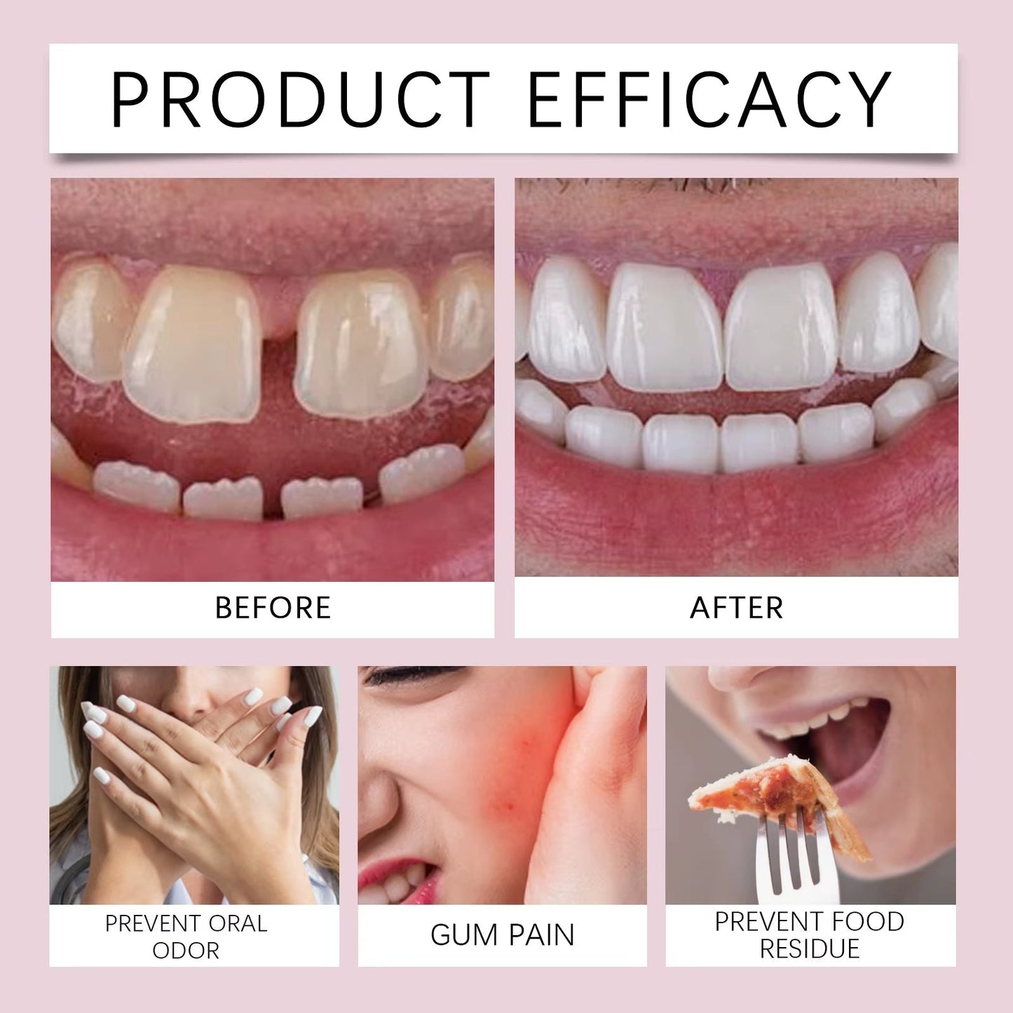 Koniec z luźnymi protezami! Najlepiej sprzedający się w Europie, trwały klej do protez.🔥