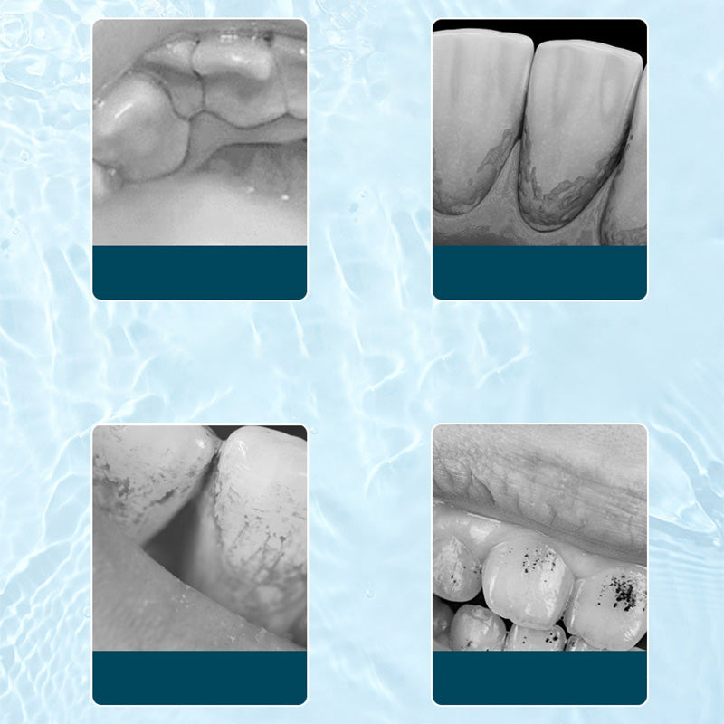 Irygator do jamy ustnej ultradźwiękowy z napędem elektrycznym