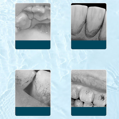 Irygator do jamy ustnej ultradźwiękowy z napędem elektrycznym