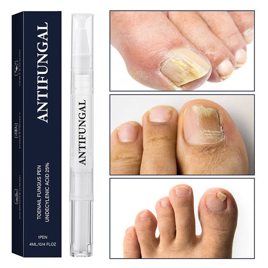 🔥Pióro do leczenia grzybicy paznokci (do paznokci zniszczonych)