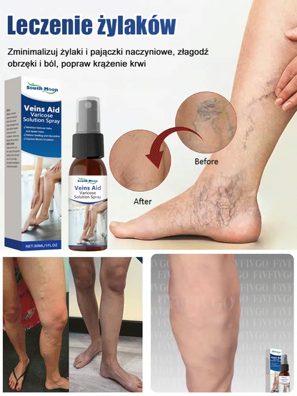 Spray do leczenia żył nóg